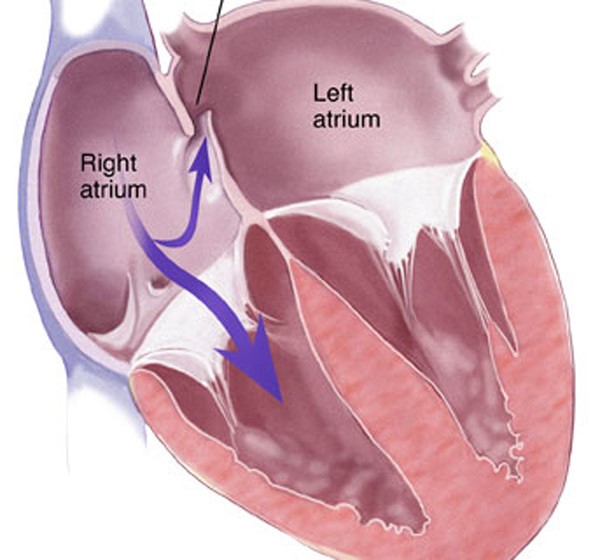 Anatomi PFO